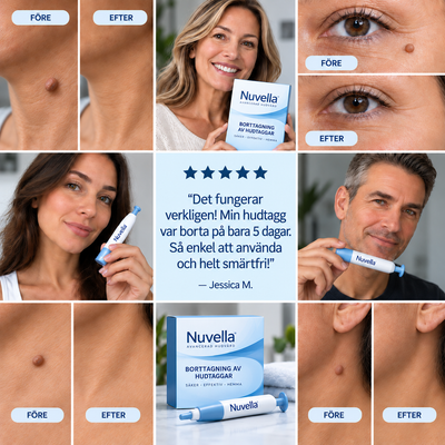 Nuvella™ Borttagning av hudflikar