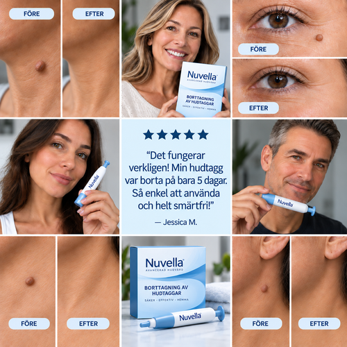 Nuvella™ Borttagning av hudflikar